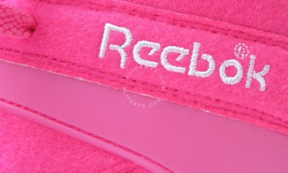 alife-reebok-ball-out-pink-detail.jpg