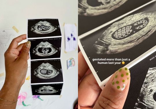 This Saucony Collaboration Just Got Teased Via Sonogram